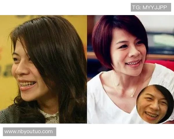 戴过牙套的足球明星们如何在赛场上展现自信与魅力 戴过牙套的足球明星们如何在赛场上展现自信与魅力